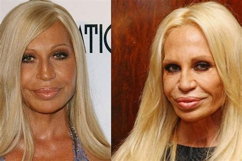 ¡Abusó de las cirugías! El antes y después de Donatella Versace